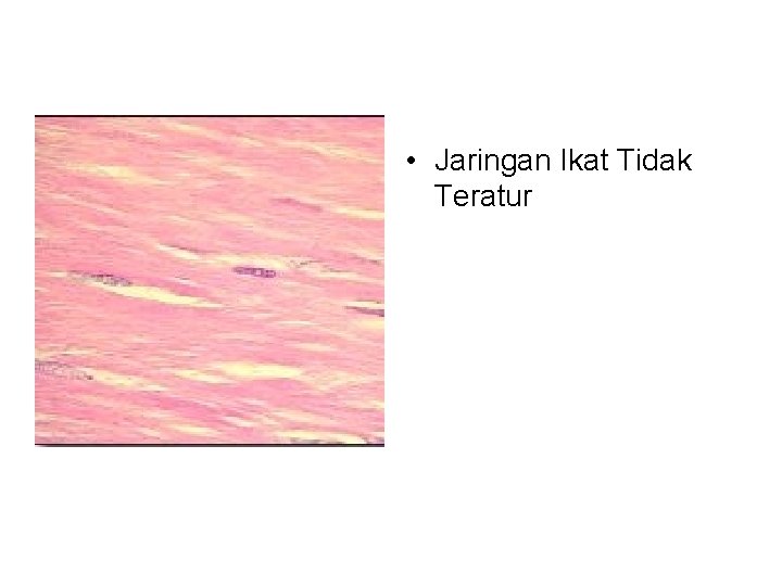  • Jaringan Ikat Tidak Teratur 