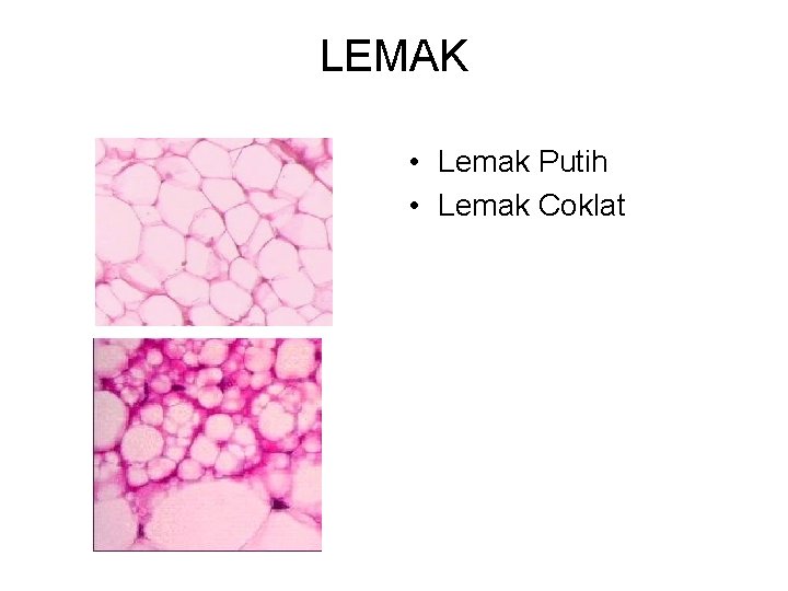 LEMAK • Lemak Putih • Lemak Coklat 