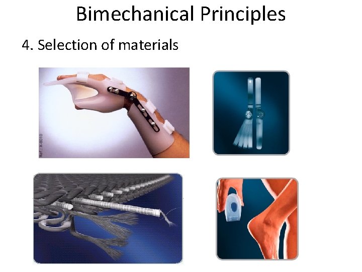 Bimechanical Principles 4. Selection of materials 