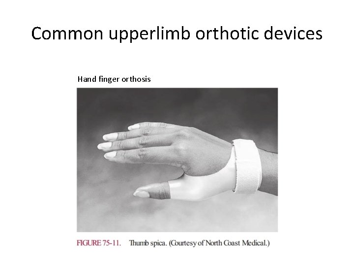 Common upperlimb orthotic devices Hand finger orthosis 