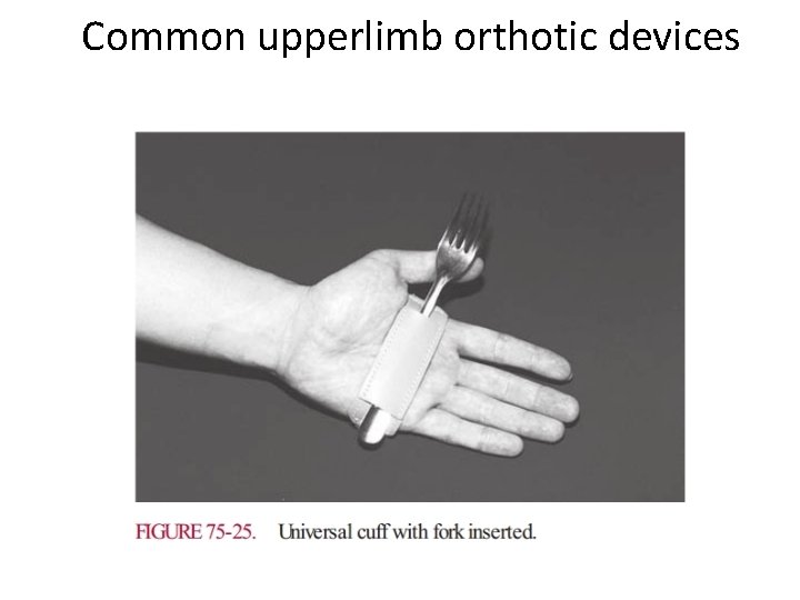 Common upperlimb orthotic devices 