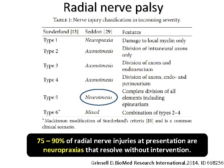 Radial nerve palsy 75 – 90% of radial nerve injuries at presentation are neuropraxias