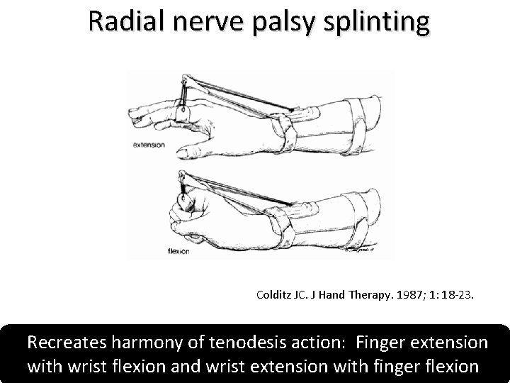 Radial nerve palsy splinting Colditz JC. J Hand Therapy. 1987; 1: 18 -23. Recreates