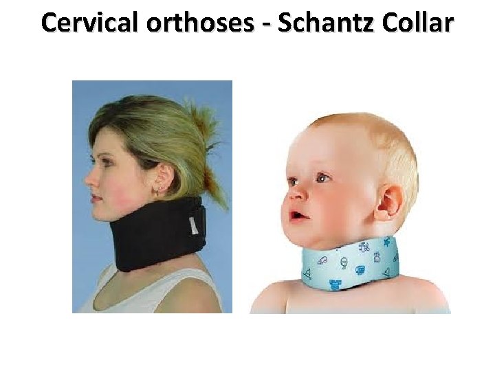 Cervical orthoses - Schantz Collar 