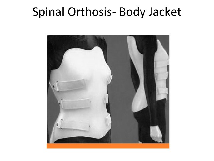 Spinal Orthosis- Body Jacket 