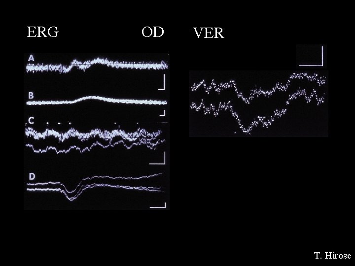 ERG OD VER T. Hirose 