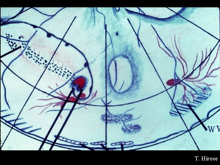 T. Hirose 