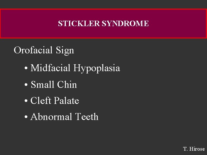 STICKLER SYNDROME Orofacial Sign • Midfacial Hypoplasia • Small Chin • Cleft Palate •