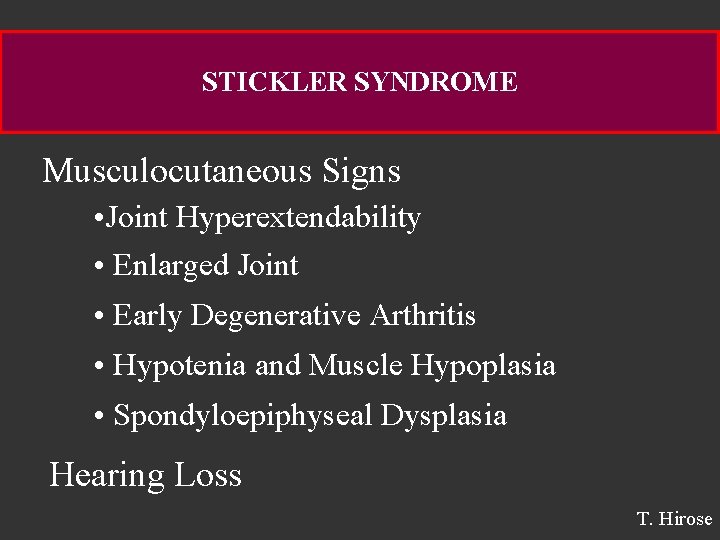 STICKLER SYNDROME Musculocutaneous Signs • Joint Hyperextendability • Enlarged Joint • Early Degenerative Arthritis