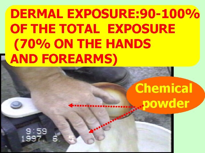 DERMAL EXPOSURE: 90 -100% OF THE TOTAL EXPOSURE (70% ON THE HANDS AND FOREARMS)