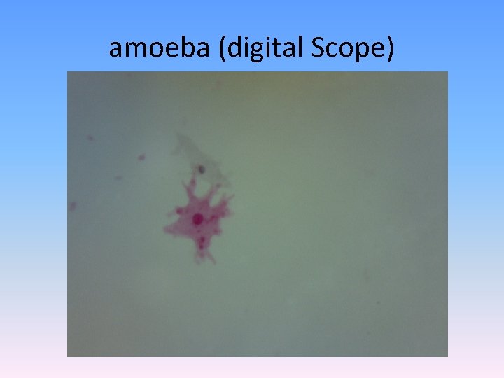 amoeba (digital Scope) 
