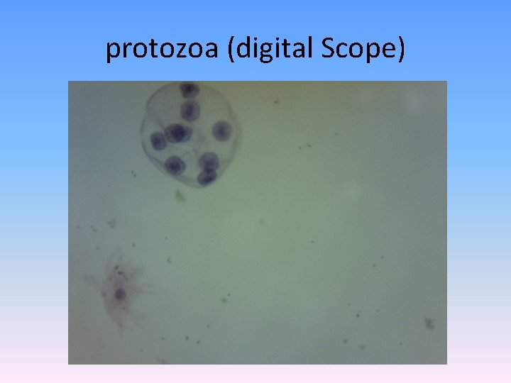 protozoa (digital Scope) 