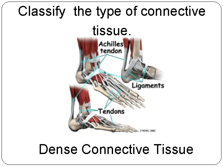 Classify the type of connective tissue. Dense Connective Tissue 