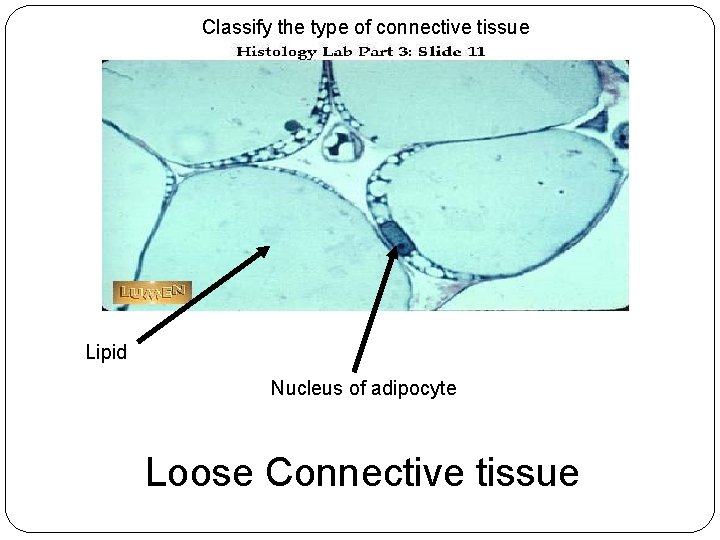 Classify the type of connective tissue Lipid Nucleus of adipocyte Loose Connective tissue 