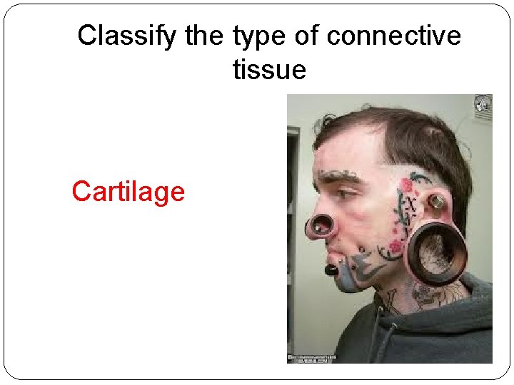 Classify the type of connective tissue Cartilage 