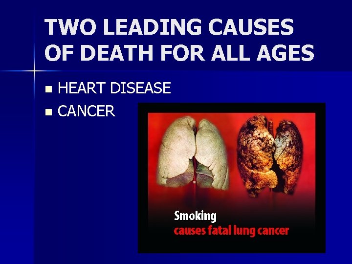 TWO LEADING CAUSES OF DEATH FOR ALL AGES HEART DISEASE n CANCER n 