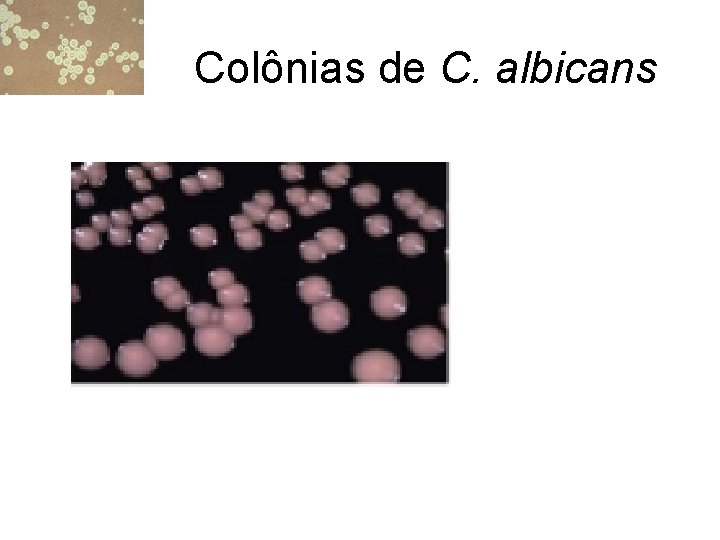 Colônias de C. albicans 