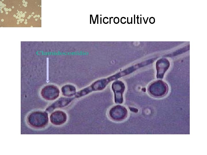 Microcultivo 