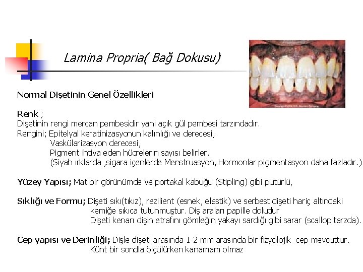 Lamina Propria( Bağ Dokusu) Normal Dişetinin Genel Özellikleri Renk ; Dişetinin rengi mercan pembesidir