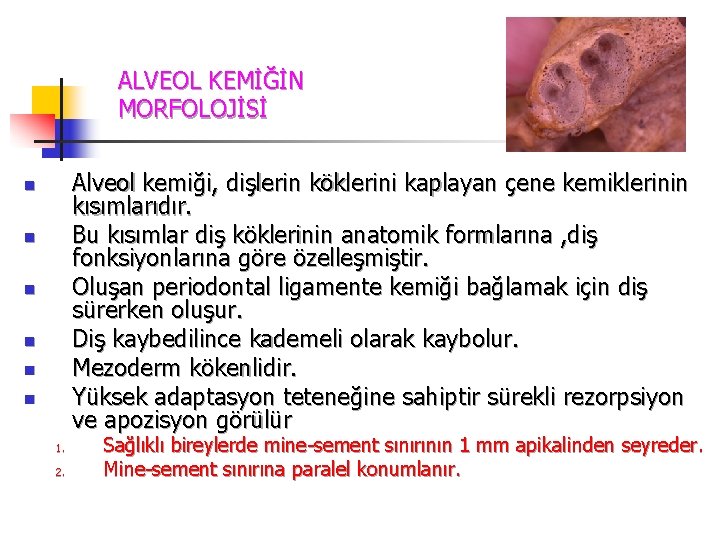 ALVEOL KEMİĞİN MORFOLOJİSİ Alveol kemiği, dişlerin köklerini kaplayan çene kemiklerinin kısımlarıdır. Bu kısımlar diş