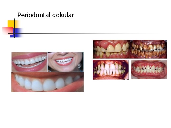 Periodontal dokular 