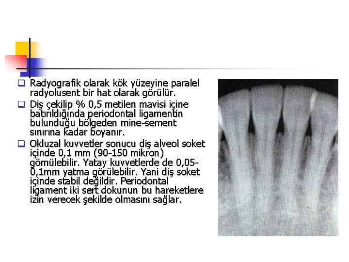 q Radyografik olarak kök yüzeyine paralel radyolusent bir hat olarak görülür. q Diş çekilip