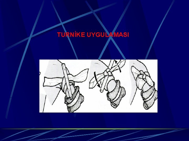 TURNİKE UYGULAMASI 