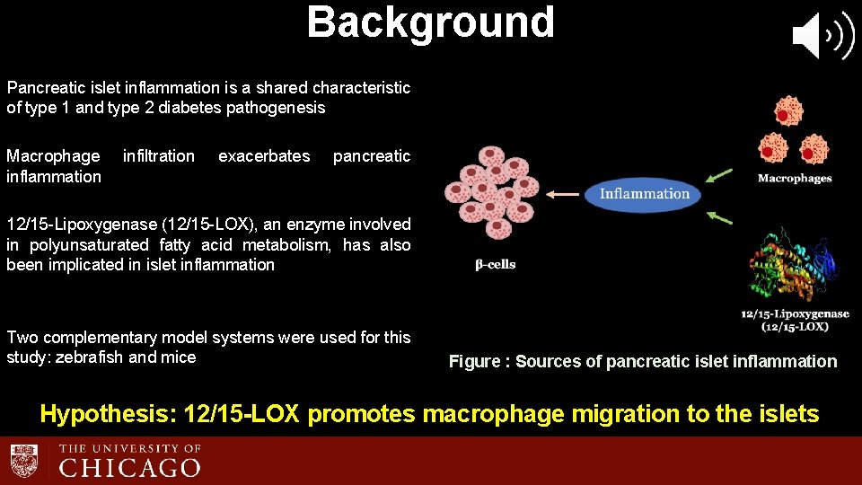 Background Pancreatic islet inflammation is a shared characteristic of type 1 and type 2 Background Pancreatic islet inflammation is a shared characteristic of type 1 and type 2