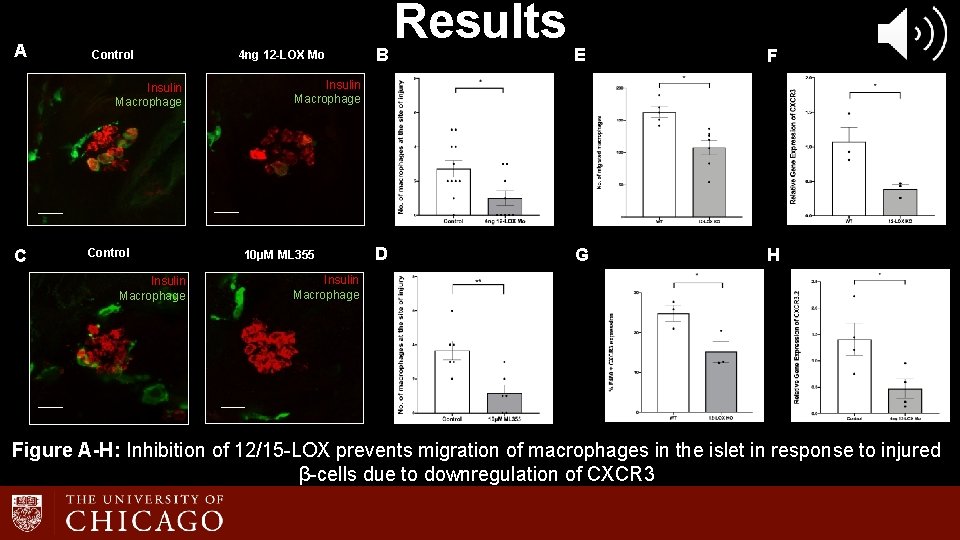 A Control Insulin Macrophage C Control Insulin Macrophage 4 ng 12 -LOX Mo B A Control Insulin Macrophage C Control Insulin Macrophage 4 ng 12 -LOX Mo B