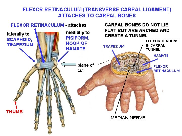 FLEXOR RETINACULUM (TRANSVERSE CARPAL LIGAMENT) ATTACHES TO CARPAL BONES FLEXOR RETINACULUM - attaches laterally