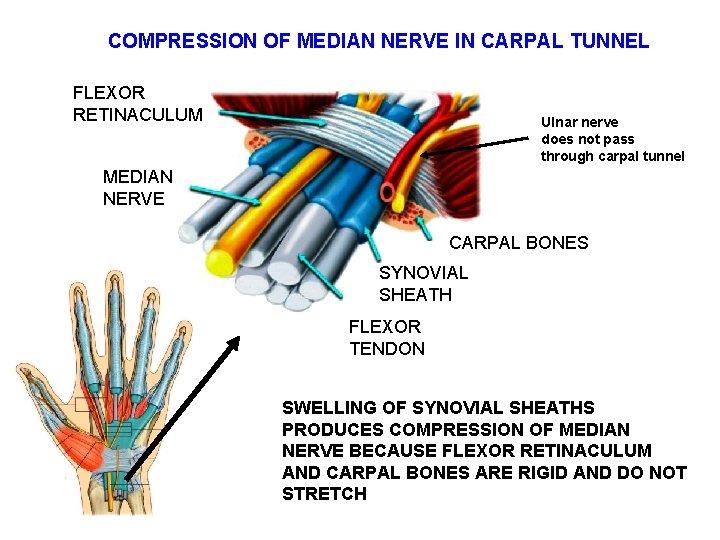 COMPRESSION OF MEDIAN NERVE IN CARPAL TUNNEL FLEXOR RETINACULUM Ulnar nerve does not pass
