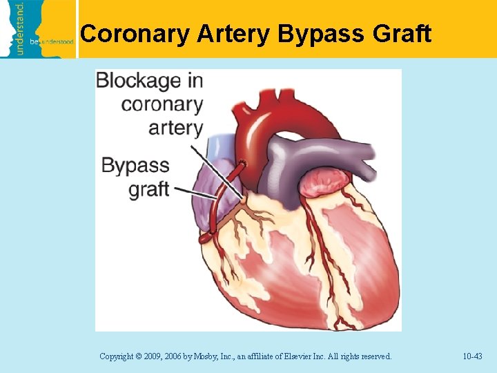Coronary Artery Bypass Graft Copyright © 2009, 2006 by Mosby, Inc. , an affiliate