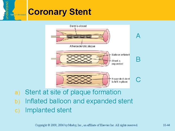 Coronary Stent A B C Stent at site of plaque formation b) Inflated balloon
