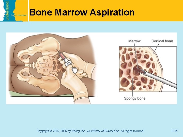 Bone Marrow Aspiration Copyright © 2009, 2006 by Mosby, Inc. , an affiliate of