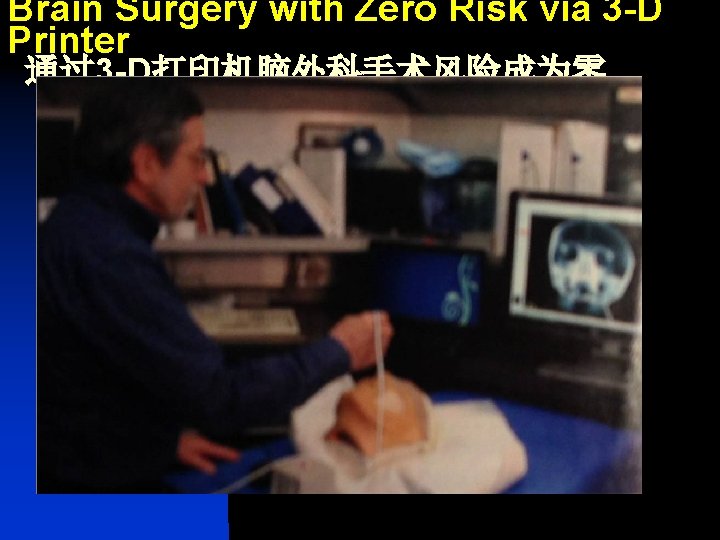 Brain Surgery with Zero Risk via 3 -D Printer 通过3 -D打印机脑外科手术风险成为零 