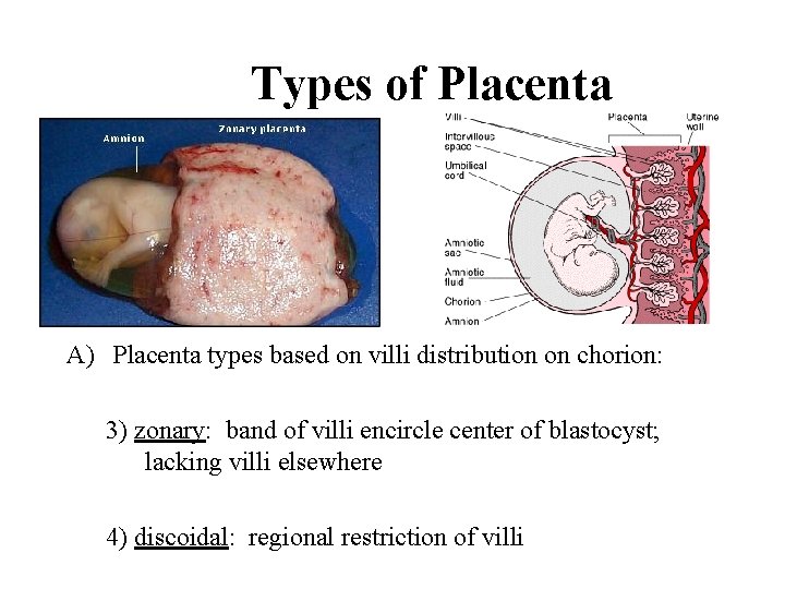 Types of Placenta A) Placenta types based on villi distribution on chorion: 3) zonary: