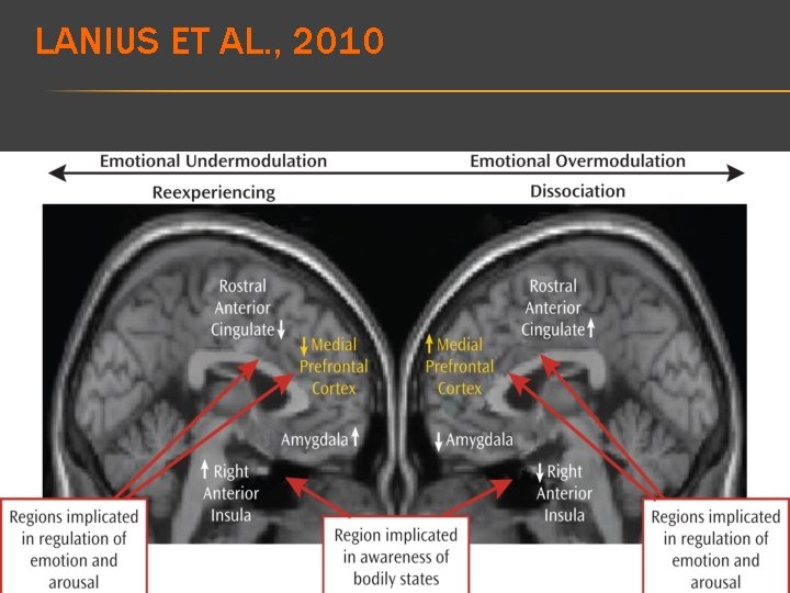 LANIUS ET AL. , 2010 