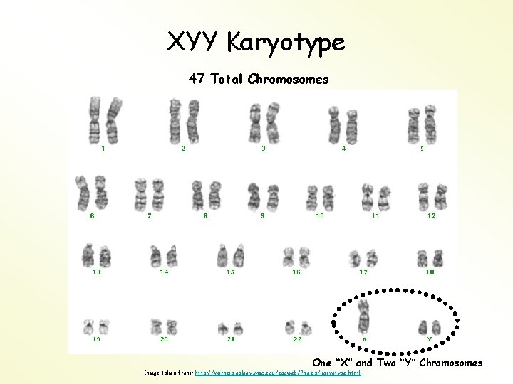 XYY Karyotype 47 Total Chromosomes One “X” and Two “Y” Chromosomes Image taken from: