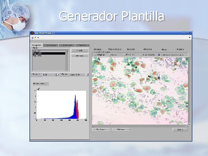 Generador Plantilla 