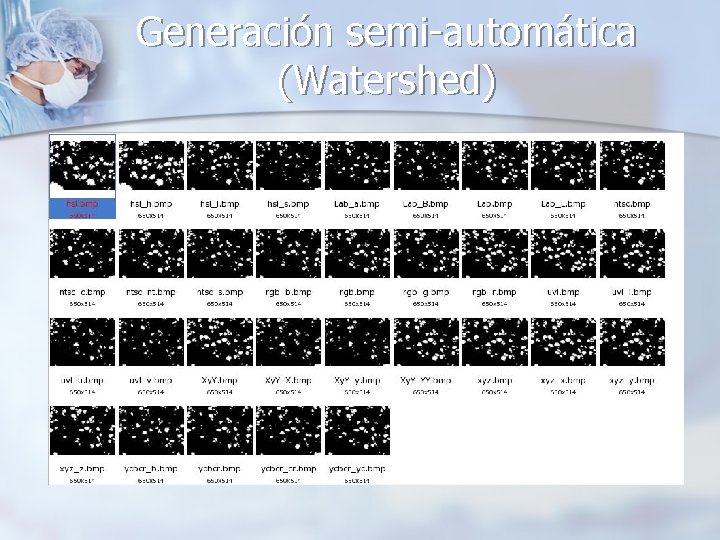 Generación semi-automática (Watershed) 