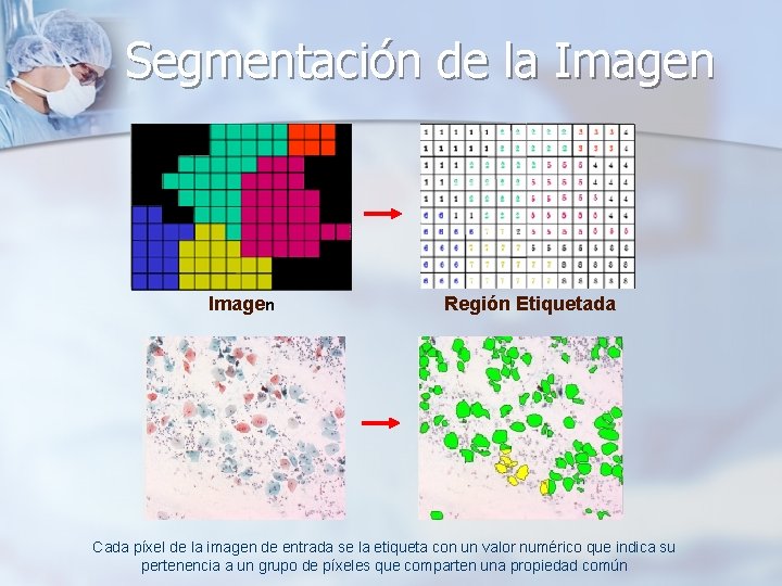 Segmentación de la Imagen Región Etiquetada Cada píxel de la imagen de entrada se