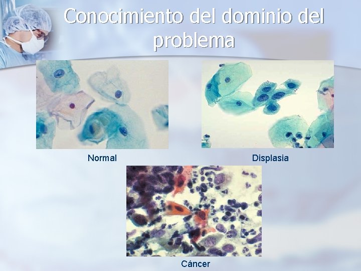 Conocimiento del dominio del problema Normal Displasia Cáncer 