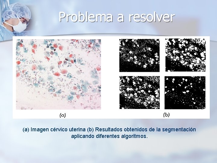 Problema a resolver (a) Imagen cérvico uterina (b) Resultados obtenidos de la segmentación aplicando