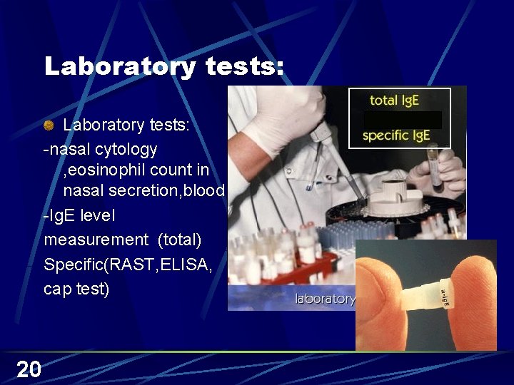 Laboratory tests: -nasal cytology , eosinophil count in nasal secretion, blood -Ig. E level