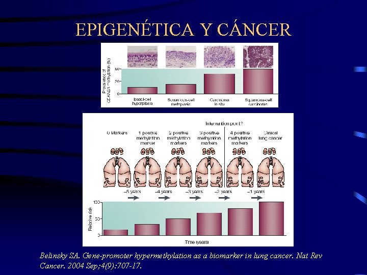 EPIGENÉTICA Y CÁNCER Belinsky SA. Gene-promoter hypermethylation as a biomarker in lung cancer. Nat