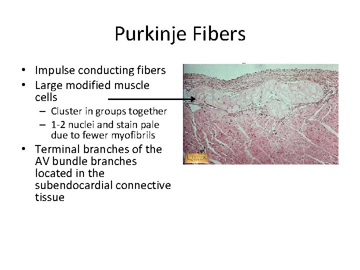 Purkinje Fibers • Impulse conducting fibers • Large modified muscle cells – Cluster in