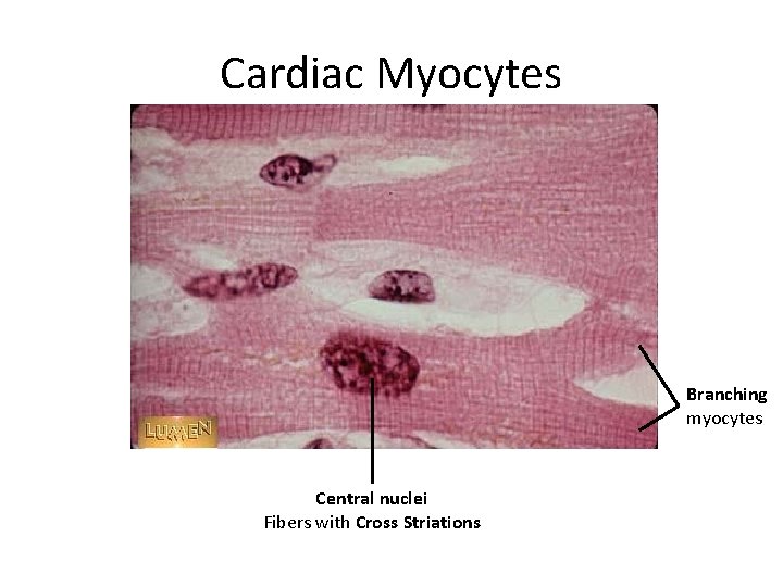 Cardiac Myocytes Branching myocytes Central nuclei Fibers with Cross Striations 