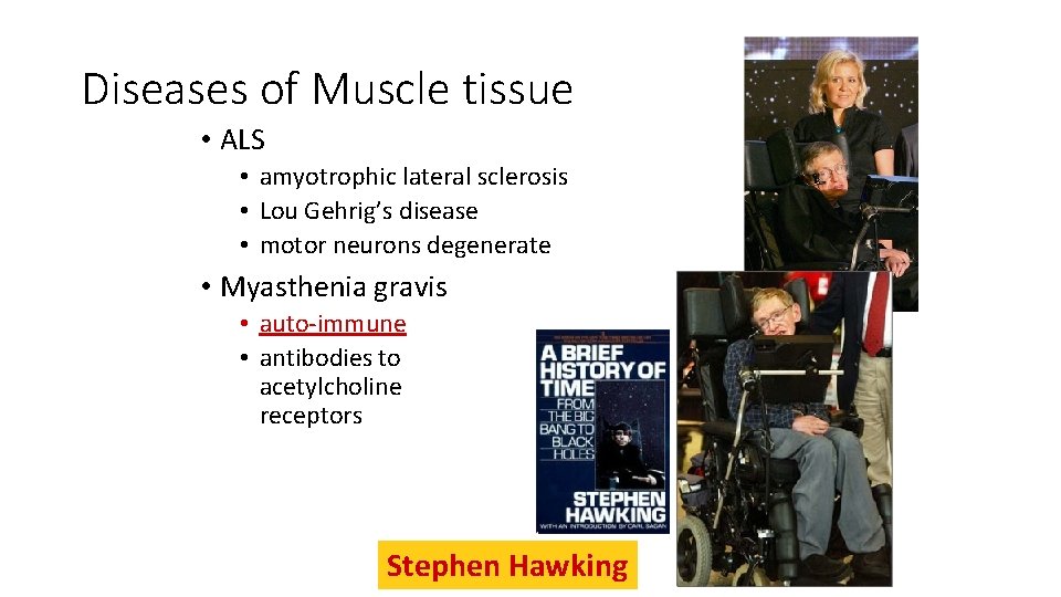Diseases of Muscle tissue • ALS • amyotrophic lateral sclerosis • Lou Gehrig’s disease