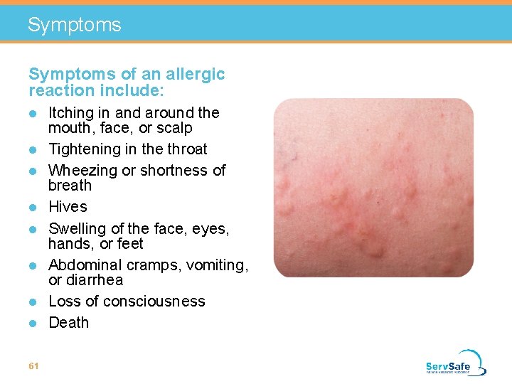 Symptoms of an allergic reaction include: l l l l 61 Itching in and