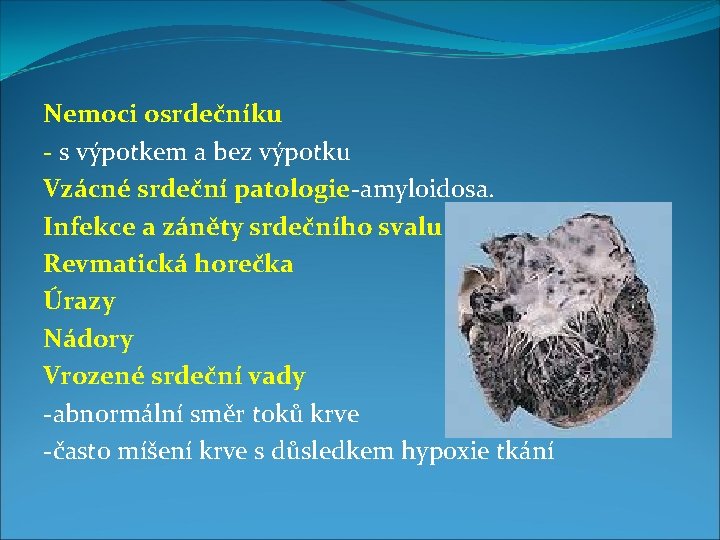 Nemoci osrdečníku - s výpotkem a bez výpotku Vzácné srdeční patologie-amyloidosa. Infekce a záněty